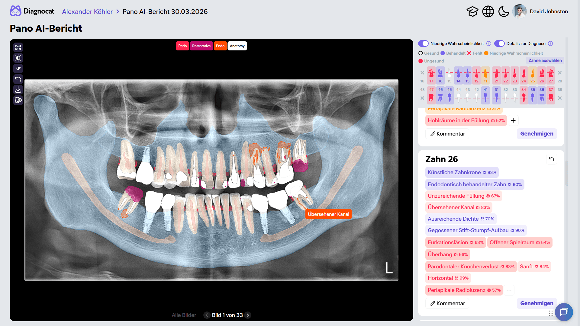 Pano AI Report GERM