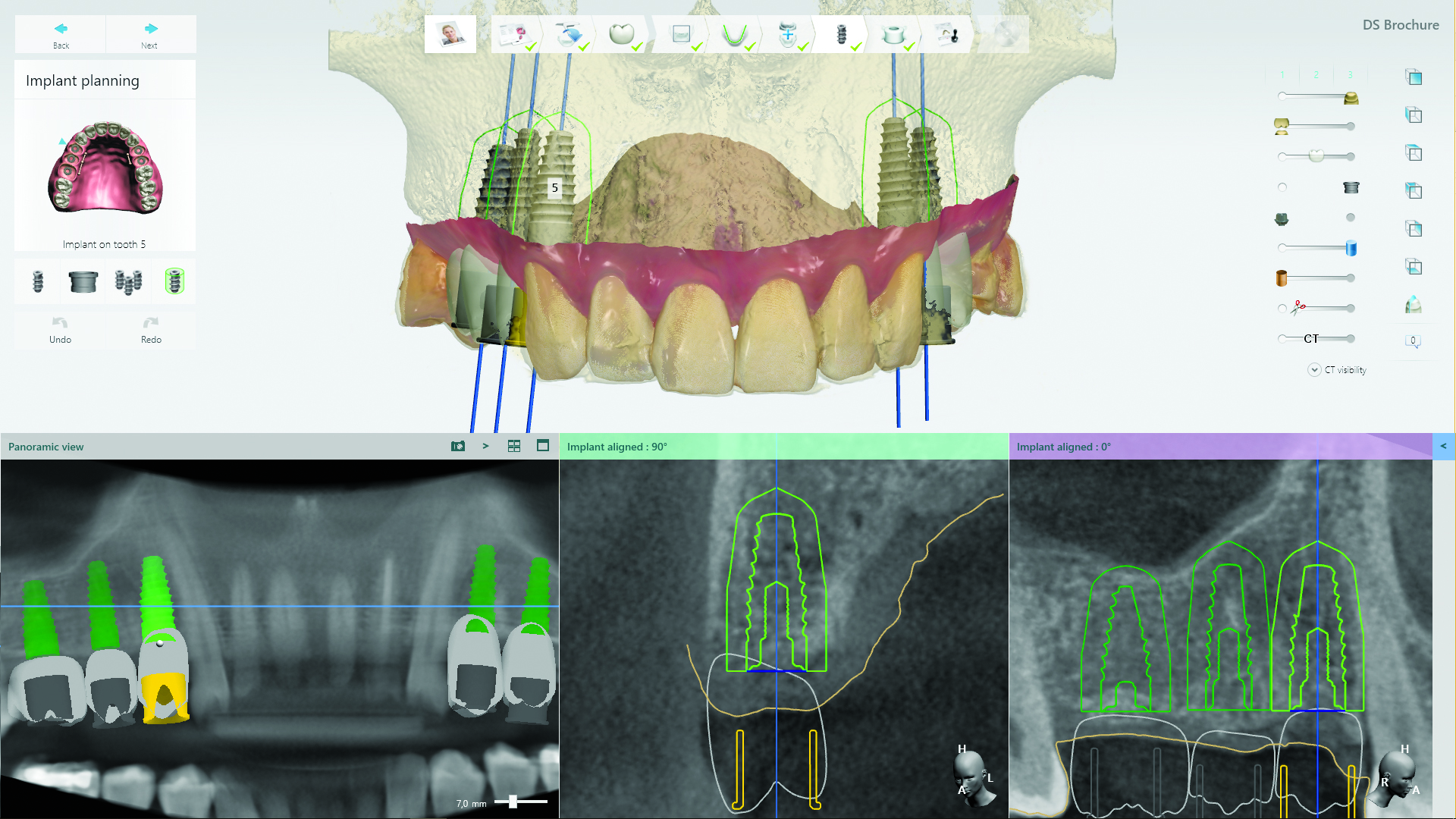 3Shape Dental Desktop